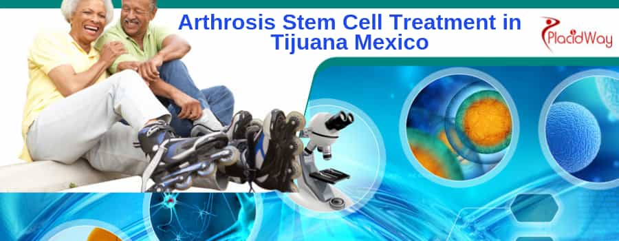 Arthrosis stem cell in Tijuana Mexico